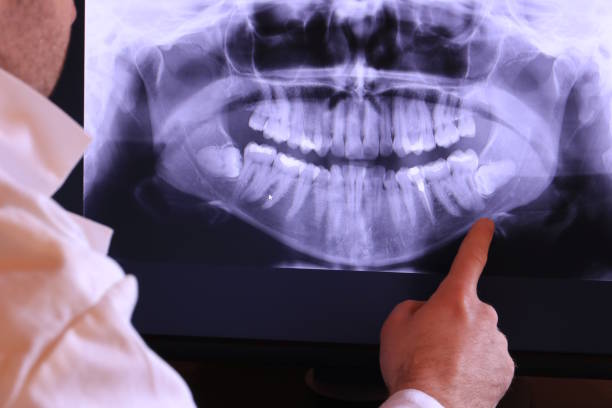 Best Emergency Dentist for Special Needs Patients in Detroit Beach, MI