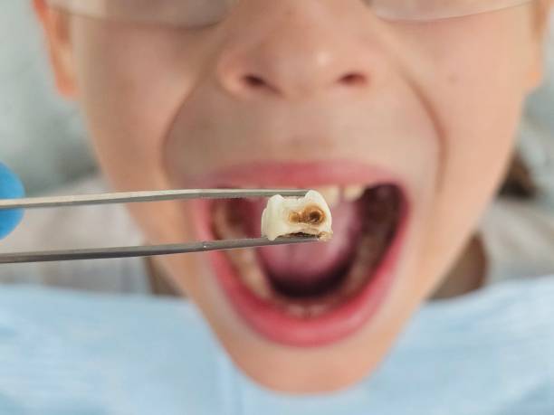 Best Weekend Emergency Dentist in Detroit Beach, MI