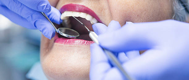 Best Emergency Dentist for Lost Fillings or Crowns in Detroit Beach, MI