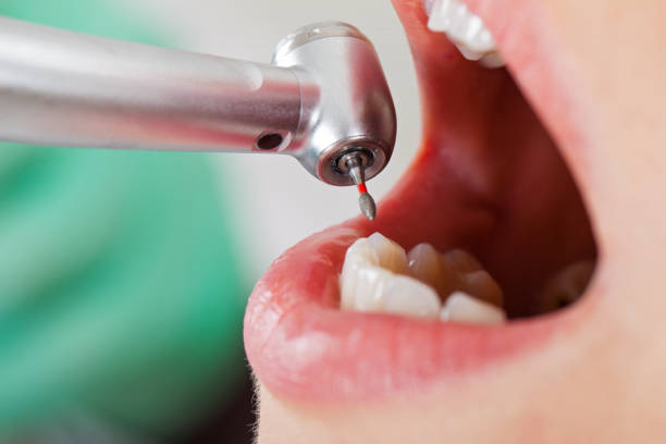 Best Orthodontic Emergency Dentist in Detroit Beach, MI